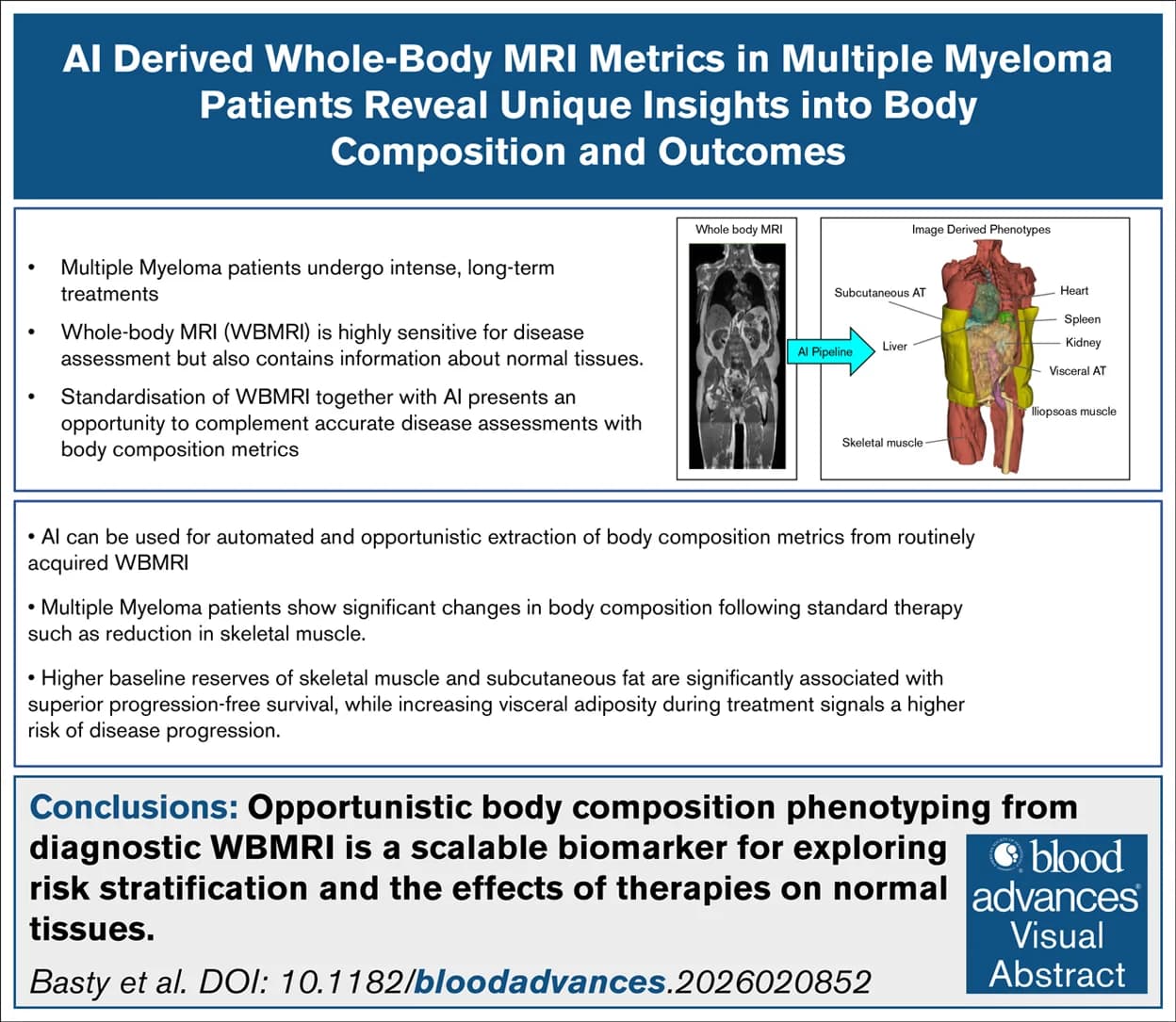Source-provided article image: AI-derived whole-body MRI metrics in patients with multiple myeloma reveal unique insights into body composition and outcomes.
