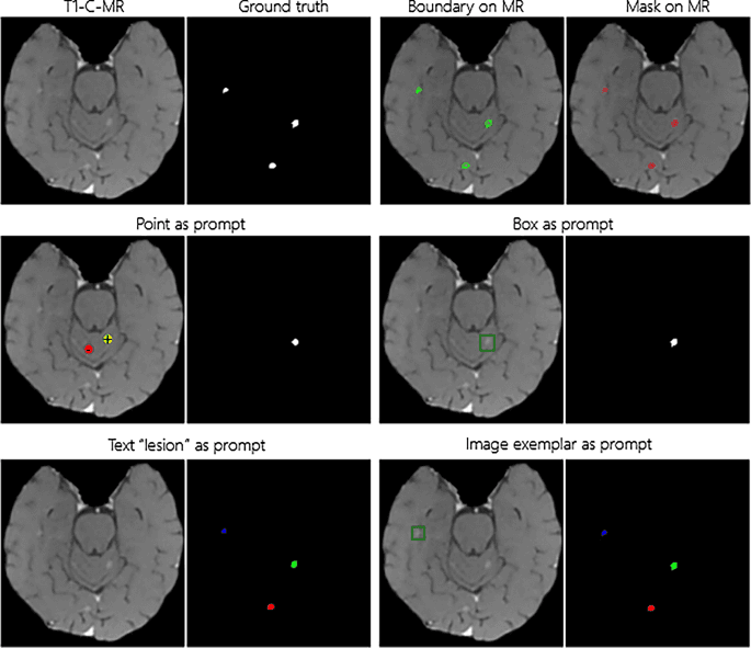 Source-provided article image: Adapting Segment Anything Model 3 for concept-driven lesion segmentation in medical images: an experimental study.