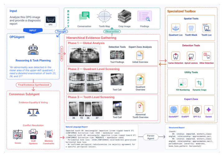 Source-provided article image: OPGAgent: An Agent for Auditable Dental Panoramic X-Ray Interpretation