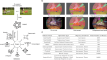 Source-provided article image: SAW: Toward a Surgical Action World Model via Controllable and Scalable Video Generation