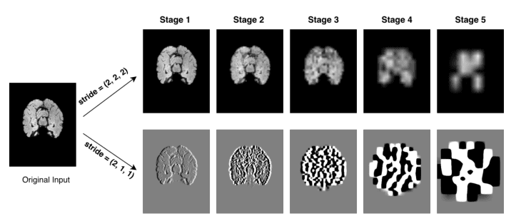 Source-provided article image: Detail Consistent Stage-Wise Distillation for Efficient 3D MRI Segmentation
