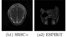 Source-provided article image: Open World MRI Reconstruction with Bias-Calibrated Adaptation