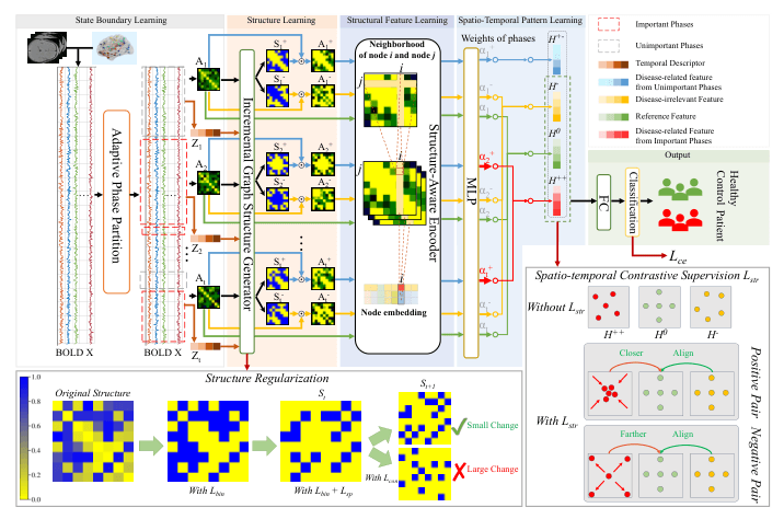 Source-provided article image: BrainSTR: Spatio-Temporal Contrastive Learning for Interpretable Dynamic Brain Network Modeling