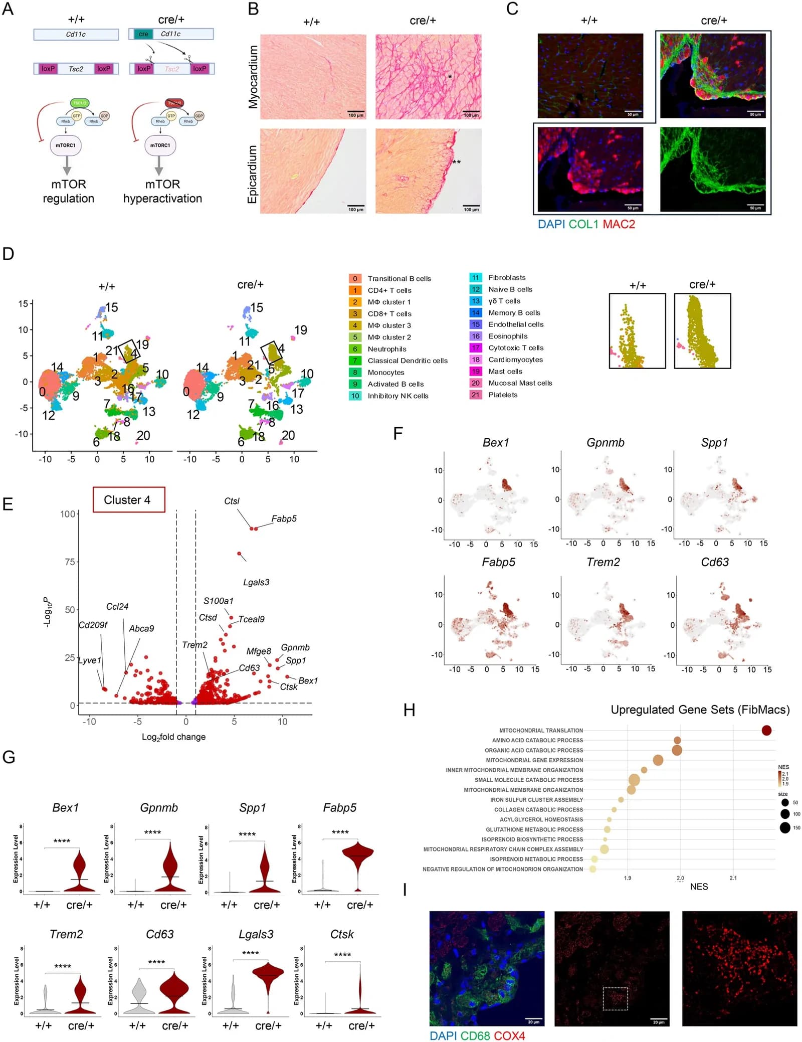 Source-provided article image: MMP12 induces fibrogenic macrophage differentiation to drive granuloma-associated cardiac fibrosis.