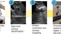 Source-provided article image: From Scanning Guidelines to Action: A Robotic Ultrasound Agent with LLM-Based Reasoning