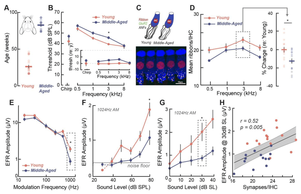 Source-provided article image: A rapid, machine-learning readout of cochlear neural degeneration that transfers from animals to humans