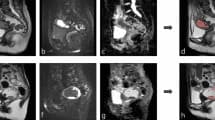 Source-provided article image: Disentangling Prompt Dependence to Evaluate Segmentation Reliability in Gynecological MRI