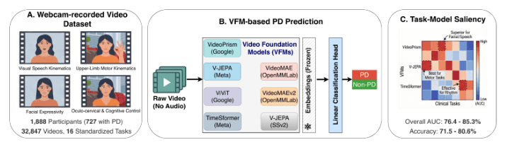 Source-provided article image: Benchmarking Video Foundation Models for Remote Parkinson’s Disease Screening
