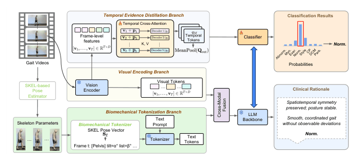 Source-provided article image: BioGait-VLM: A Tri-Modal Vision–Language–Biomechanics Framework for Interpretable Clinical Gait Assessment