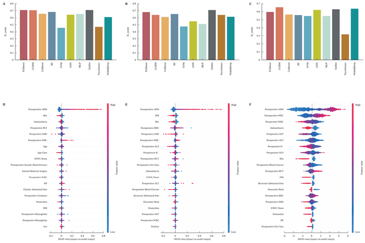 Source-provided article image: Machine learning for early post-ESWL risk stratification of pancreatitis in chronic pancreatitis.
