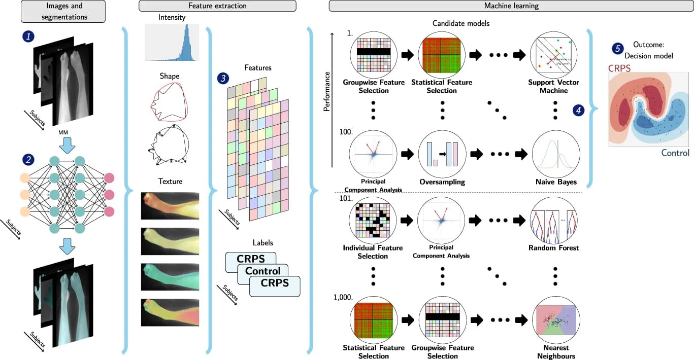 Source-provided article image: Automatic quantification of thermographic images of complex regional pain syndrome using radiomics and deep learning.