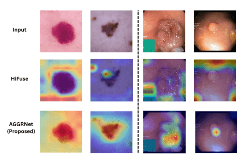 Source-provided article image: AGGRNet: Selective Feature Extraction and Aggregation for Enhanced Medical Image Classification